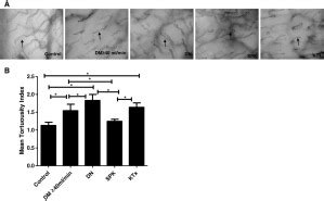 Microvascular Damage in Type 1 Diabetic Patients Is Reversed in .